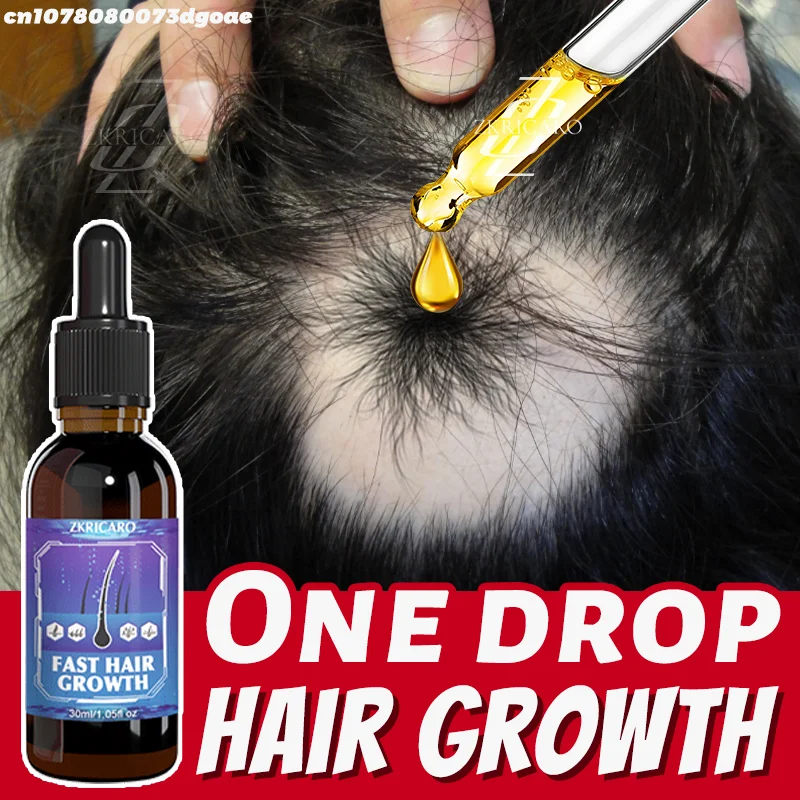 Officiële directe verkoop zorgen voor succesvol gedragen 30w+ mensen ontdoen met haaruitval