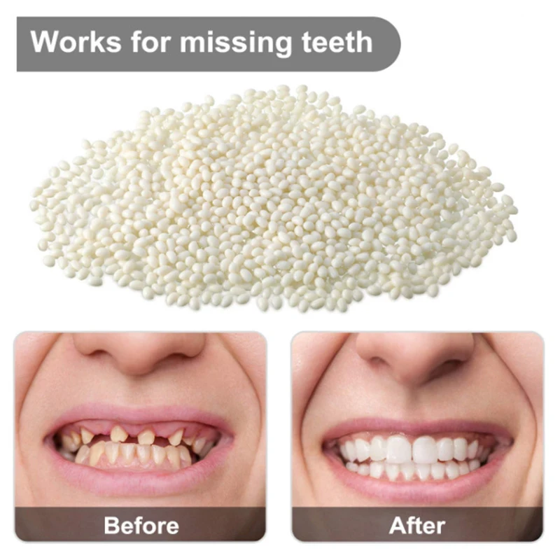 ResinTemporary Tooth Repair Kit Teeth And Gaps FalseTeeth Solid Glue Denture Adhesive Teeth Whitening Tooth Beauty 5g/20g