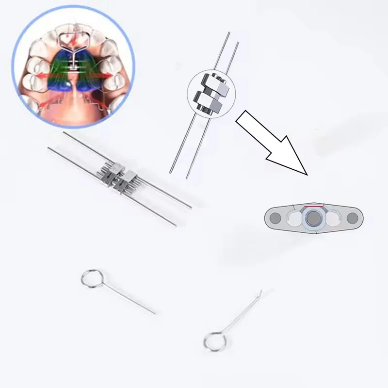 Dental Orthodontic Expansion Screw Frame Type Stainless Steel 8/9/11/13mm Rapid Palatal Expander Dentistry Ortho Tools Material