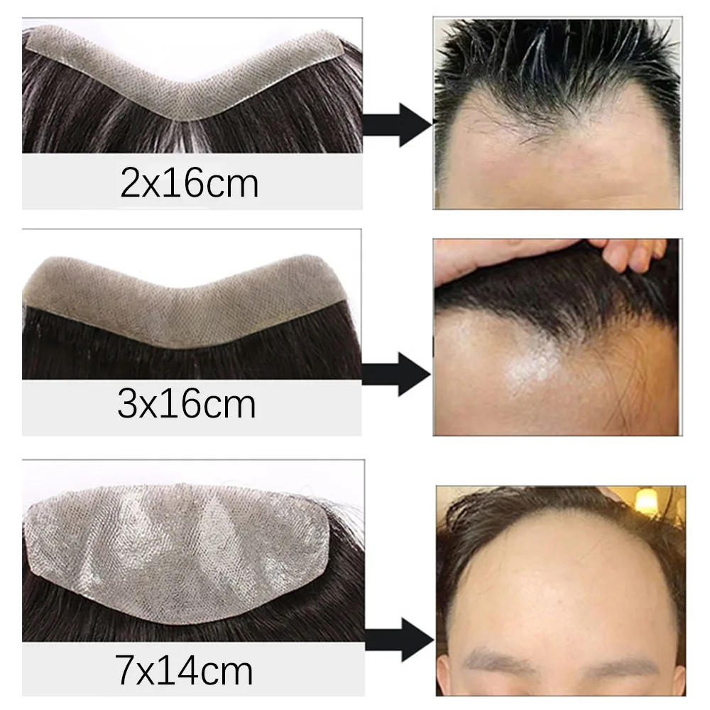 Toupee 남성용 이마 헤어피스 패치, 내추럴 블랙 인모, 얇은 피부 PU, 모세관 보형물