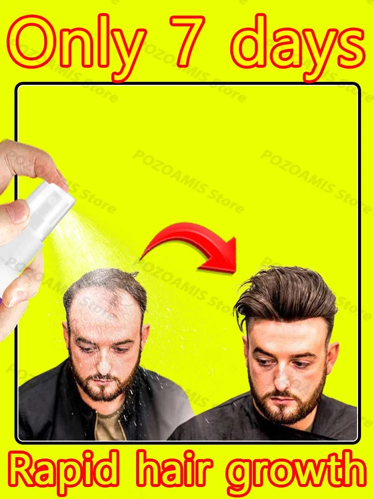 

Успокаивание программиста: Код может быть лысины, но моему головы не может!