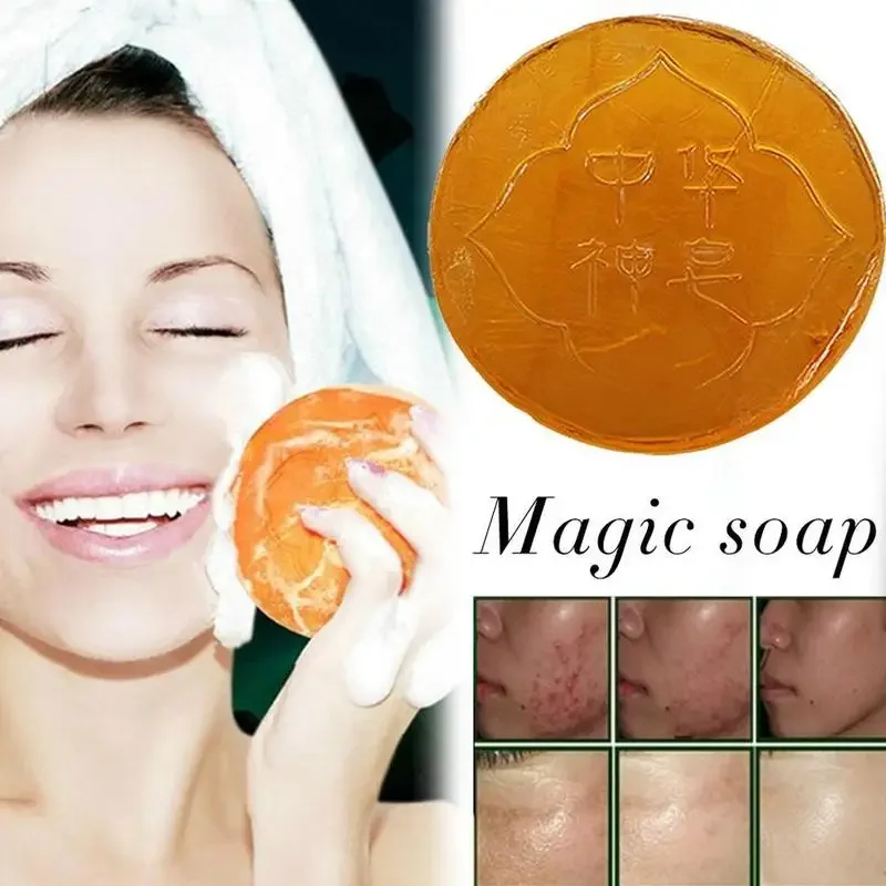 Magic Oil Control Soap Body Skin Exfoliating Whitening Natural Bath Oil Soap Shower Remover Cleansing Magic Soap 58g