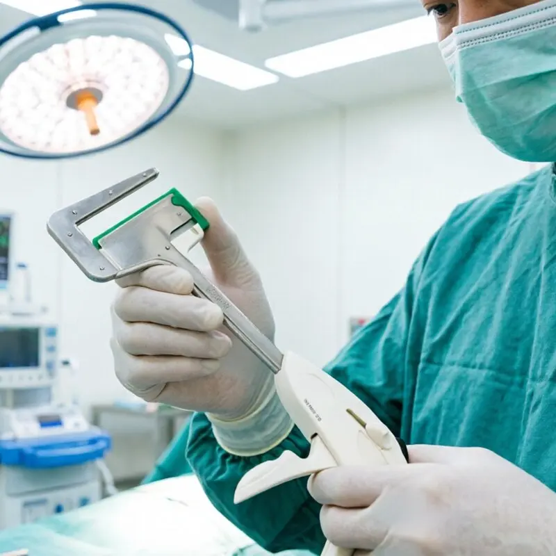 Manual Use Grade Disposable Linear Surgical Stapler Reloads for Abdominal Surgery