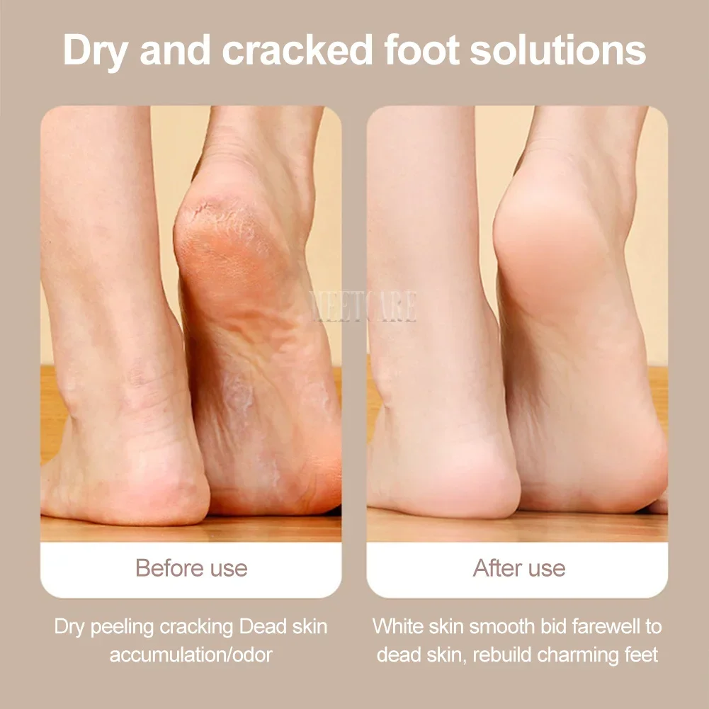 Mini Electric Pedicure Foot Grinder with LED Dry Peel USB Charging 3 Grinding Wheel Waterproof Foot Exfoliating Calluses Tool