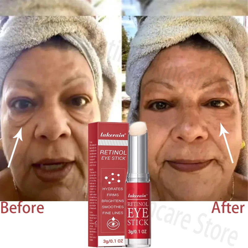 

Anti Wrinkle Eye Cream Retinol Facial Lift Tighten Fade Fine Line Anti Puffiness Remove Dark Circles Whiten Moisturize Skin Care