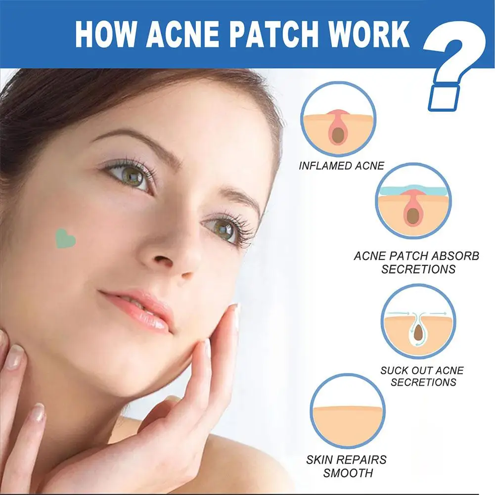 1 scatola Acne brufolo Patch Anti-acne correttore di aspirazione anale Patch invisibile che copre Zits e macchie adesivi per brufoli