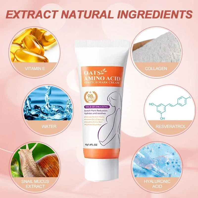 Remove Skin Cracks Repair Firming Care Stretch Marks Moisturize Cream Eliminate Body Belly Stretch Marks Removal Swelling Marks