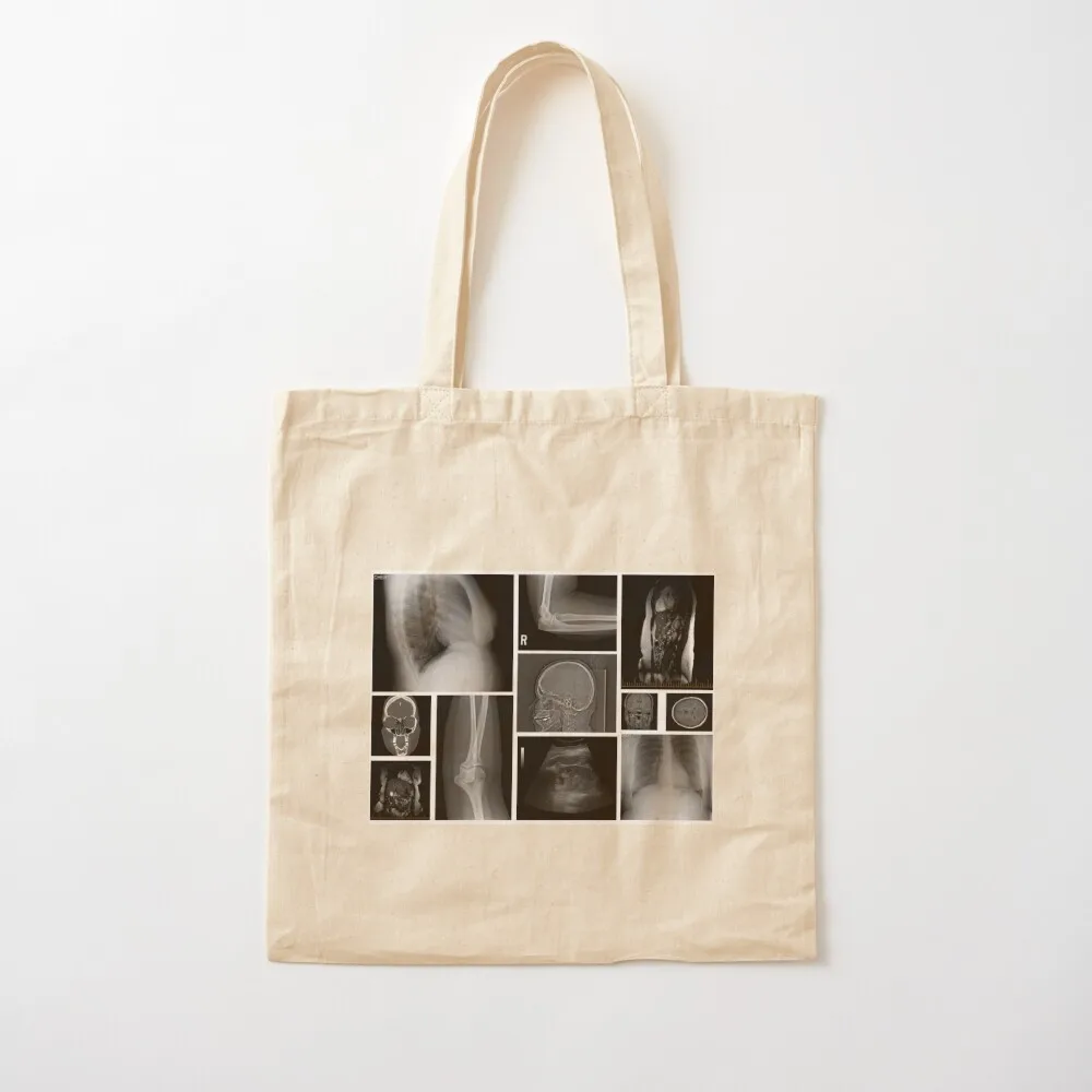 Trapped in my Body - X-Ray Tote Bag female bag shopping bag shopper women