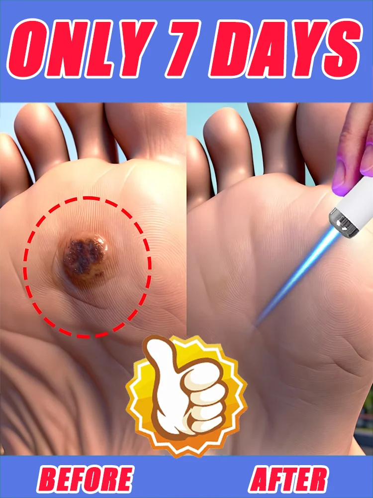 

Эффективное средство для удаления бородавок, не оставляющее следов и предотвращающее повторное появление.