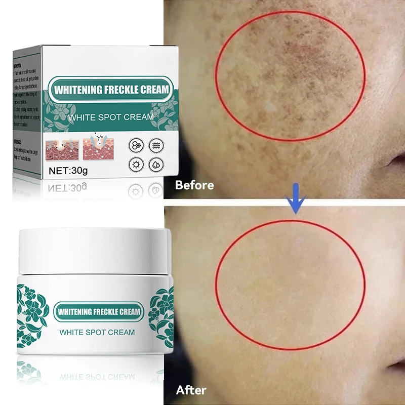 Niacinamide Melasma-Verhelderingscrème Vermindert Melanine Verbetert Droog Dof Voor Vrouwen Die De Huidverlichtende Verzorging Van Gezichtsvocht Aanvullen