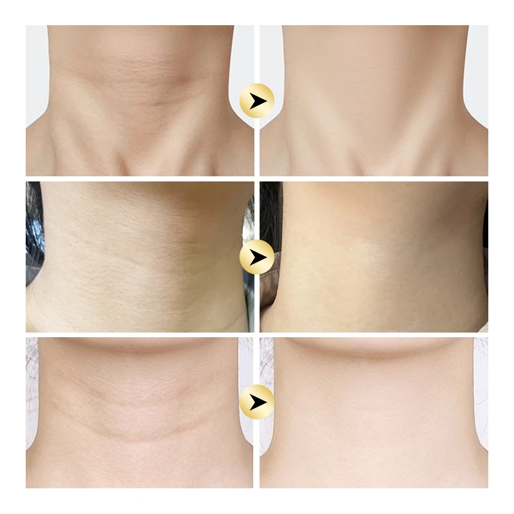 Crème pour le cou tout-en-un AH-8 avec rouleau, Anti-vieillissement, lifting instantané, raffermit la peau, lisse, rides, ingrédients naturels, absorption rapide