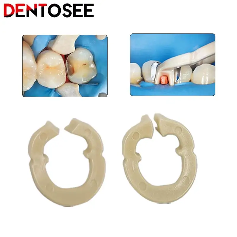 Dental Resin Clamping Ring Separator Ring Sectional Contoured Metal Matrices Holder Matrix Fixed Clamp Autoclavable