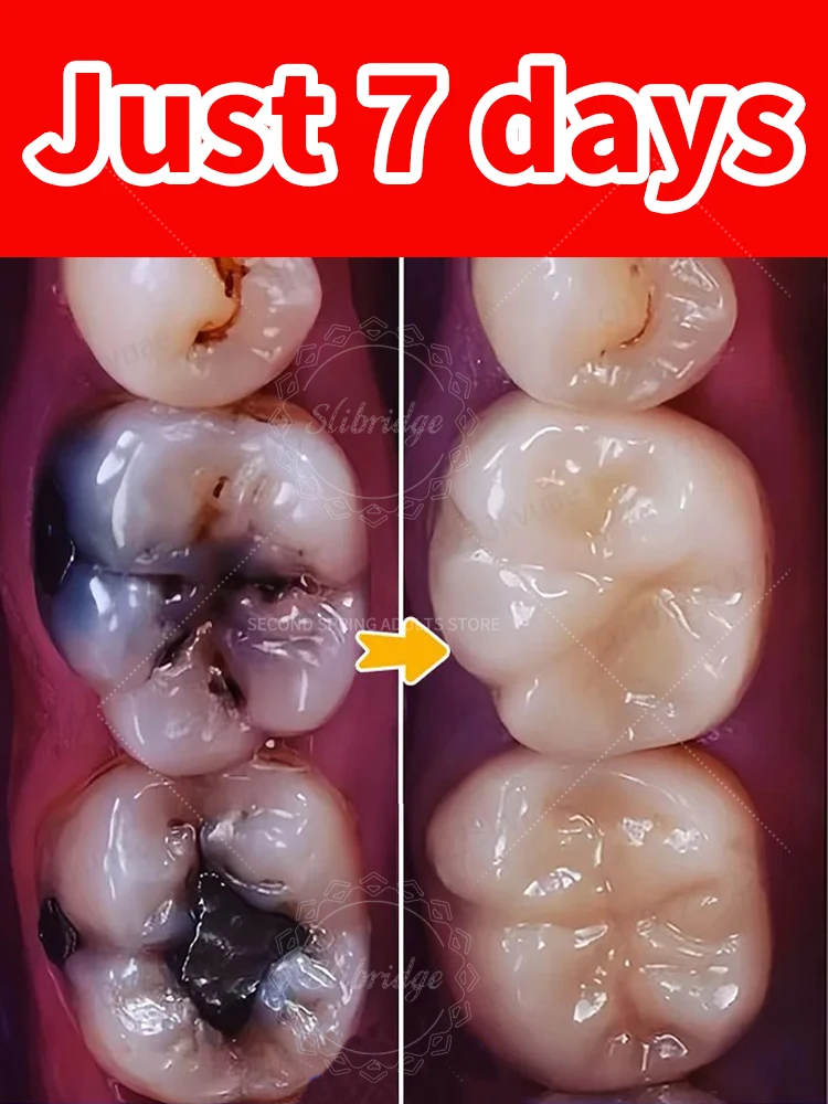 

2025 new tooh Decay repair Suitable for all ages Family Package