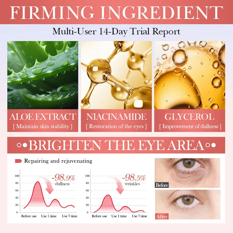 Recommend Watermelon Nicotinamide Eye Cream Moisturizing Eye Cream