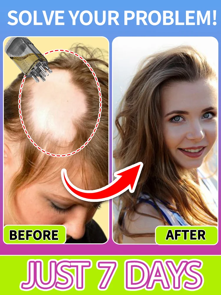 

From Thin To Thriving Transform Your Hair And Appearance In Just 7 Days