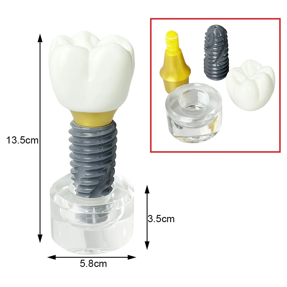 Dental Implant Structure Model Removable Crown Abutment Screw Clear Base Teeth Implant Teach Model for Dentist Patient Education
