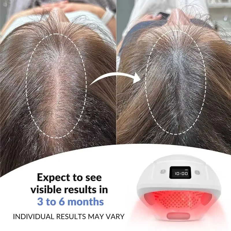 GOVW Professional Hair Growth Helmet Laser Hair Therapy Cap Red Light Therapy Helmet 448 Diodes LLLT for Hair Thinning Dandruff