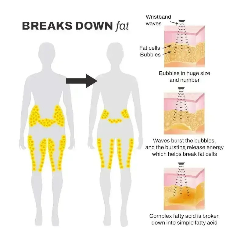 초음파 림프 배수 슬림핏 손목 밴드, 무게추 손실 팔찌, 무게추 손실 팔찌, 자기 치료, 지방 연소 건강 시계