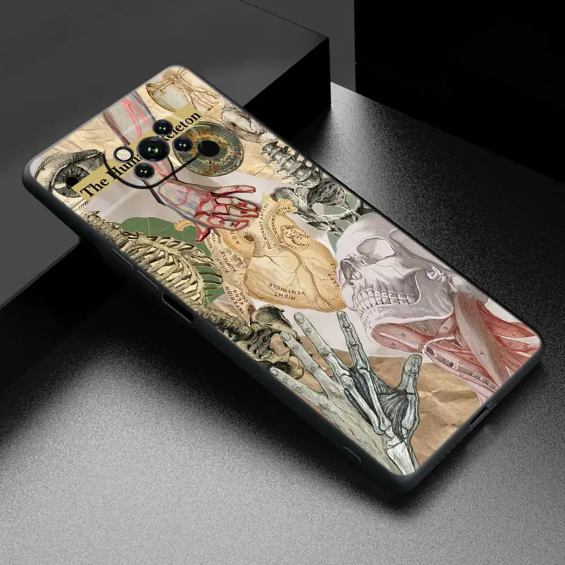 Medical Human Organs Black Phone Case For Xiaomi Mi POCO M6 Pro F5 X5 X4 X3 NFC M5S M3 M4 Pro 5G F3 F4 GT F1 F2 Cartoon Cover