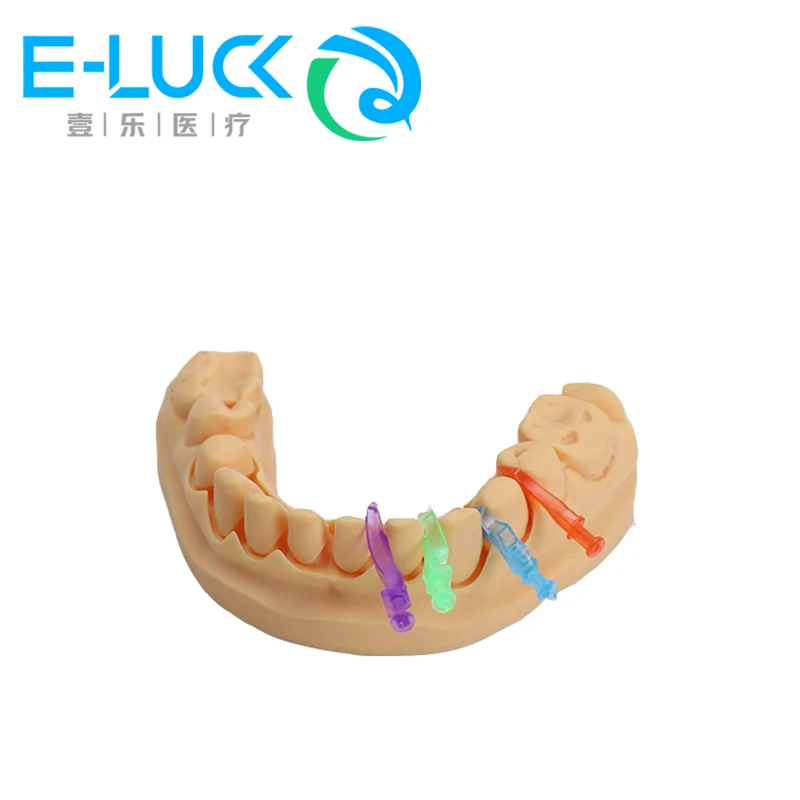 Diamentowe kliny dentystyczne jednorazowe plastikowe kliny międzyzębowe Błotniki barierowe matryce kompozytowe odbudowa stomatologii akcesoria