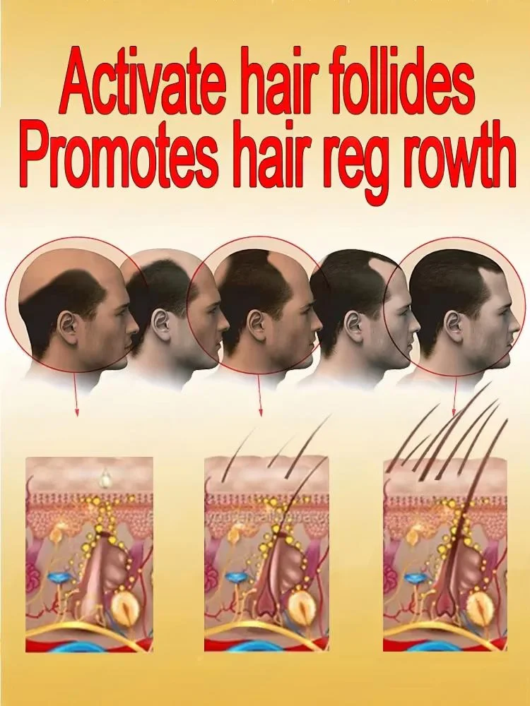 ปลุกเส้นผมที่ยังไม่ได้เติบโตให้เกิดการเติบโตอย่างมากมาย