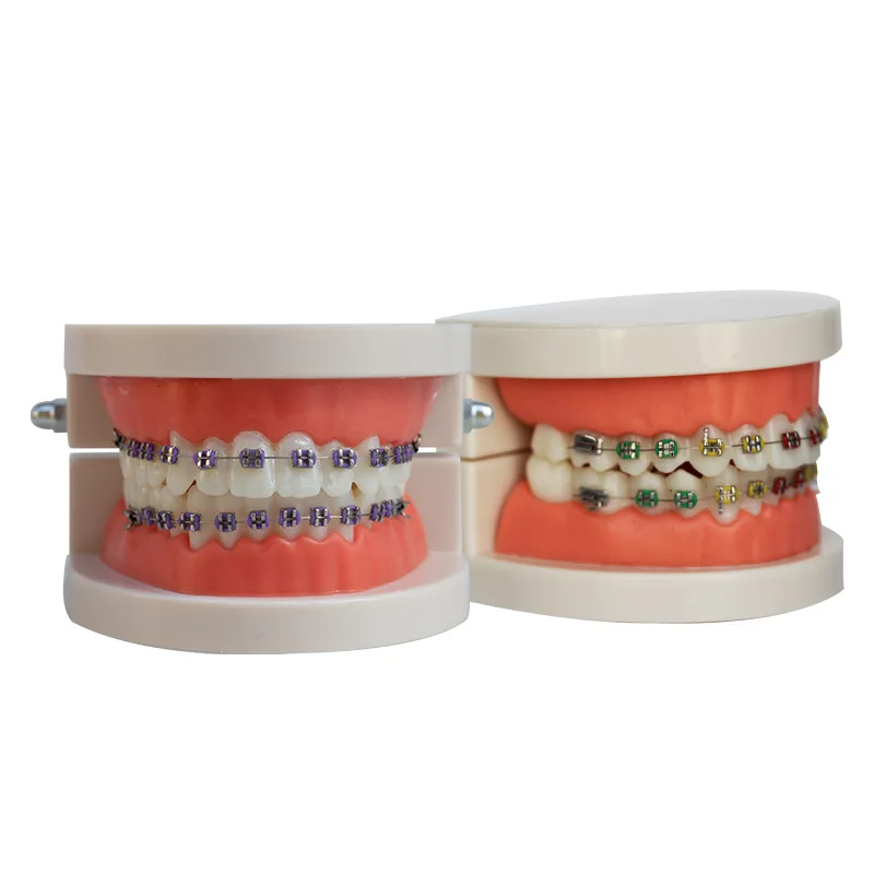 5Pcs Dental Orthodontic Treatment Teeth Model With Bracket Arch Wire Buccal Tube Ligature Ties Dentist Lab Tooth Model TeachTool