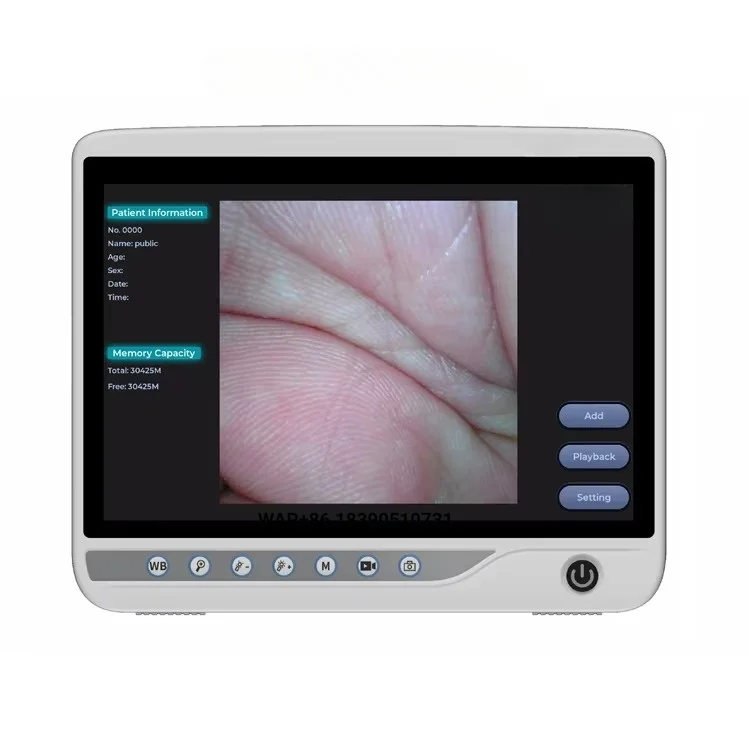 New Product Customized Medical Video Endoscope Machine Gastroscope Colonoscope Animal Veterinary Endoscope