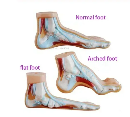 3pcs Set 1:1 Lifesize Human Normal Flat Arched Foot Anatomical Model PVC Anatomy School Lab Supplies