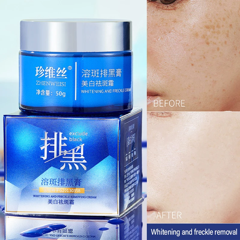 

Effective Freckle Cream Remove Melasma Sunburn Whitening Brightening Dark Spot Corrector Acne Marks Dullness Skin Care 50g