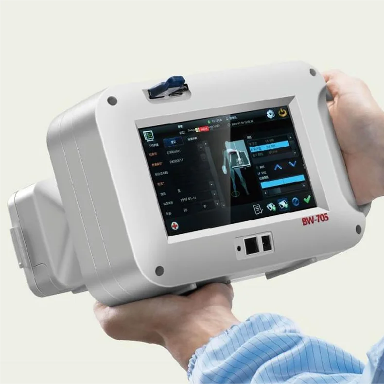 Portable Medical X-Ray Handheld Medical Handheld X-Ray Machine Medical DR System Price Portable X-Ray Machine