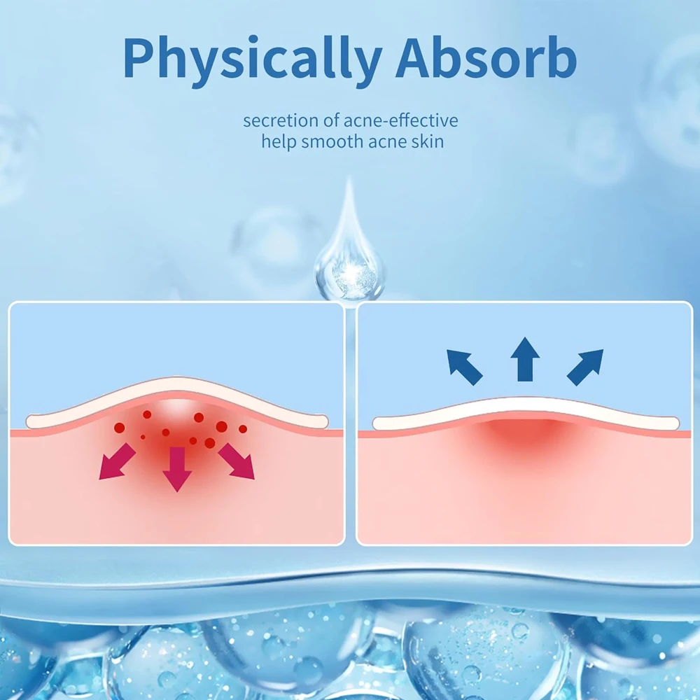 Star Acne Patch Dissolvenza Riparazione Adesivi invisibili per la rimozione dell'acne Simpatico correttore Strumento per il trucco Stile stella con scatola di immagazzinaggio a specchio