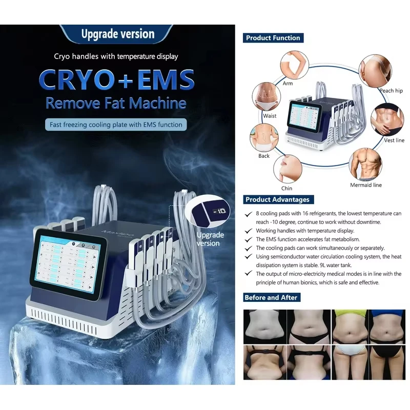 Cryolipolysis Slimming Machine Cellulite Removal Paddles Fat Burning Weight Loss Cryotherapy Slimming Machine