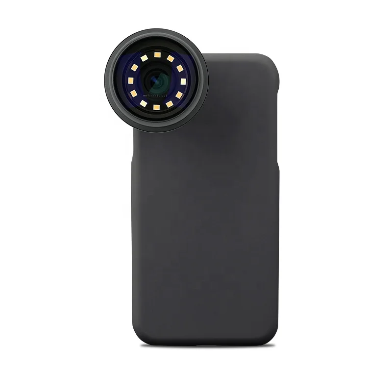 IBOOLO Factory Supply DE-400 CE Professional Rechargeable Dermatoscope For Skin Cancer Dermoscopy