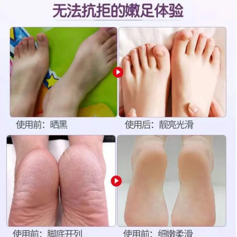 Japanese Horse Oil Foot Mask Exfoliation Calluses Horny Heel Dry Cracked Foot Sole