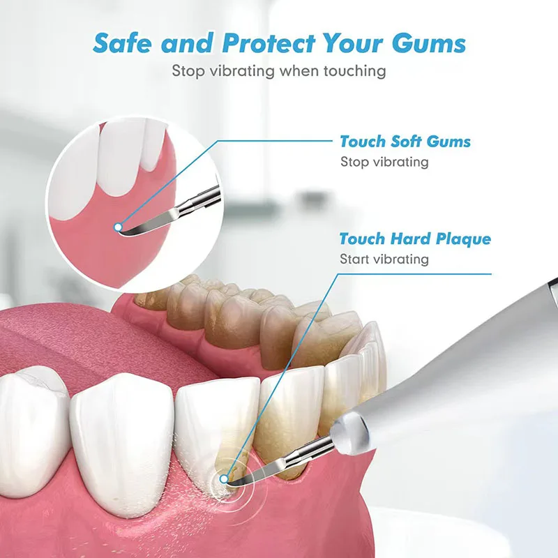 Ultrasonic Dental Scaler For Home Use Removes Tartar From Teeth, Smoke Stains, Stains,Food Stickiness Oral Cleaning Dental Stone