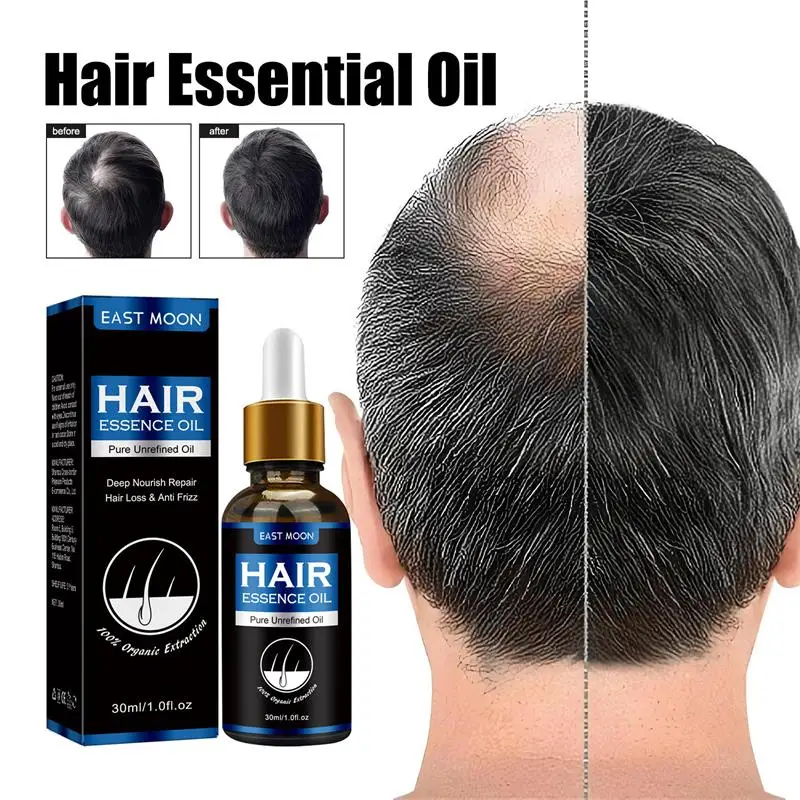 Soro eficaz do regrowth do cabelo para homens e mulheres, Produto do crescimento do cabelo, Fast Grow, Prevenir a calvície, Tratamento da alopecia