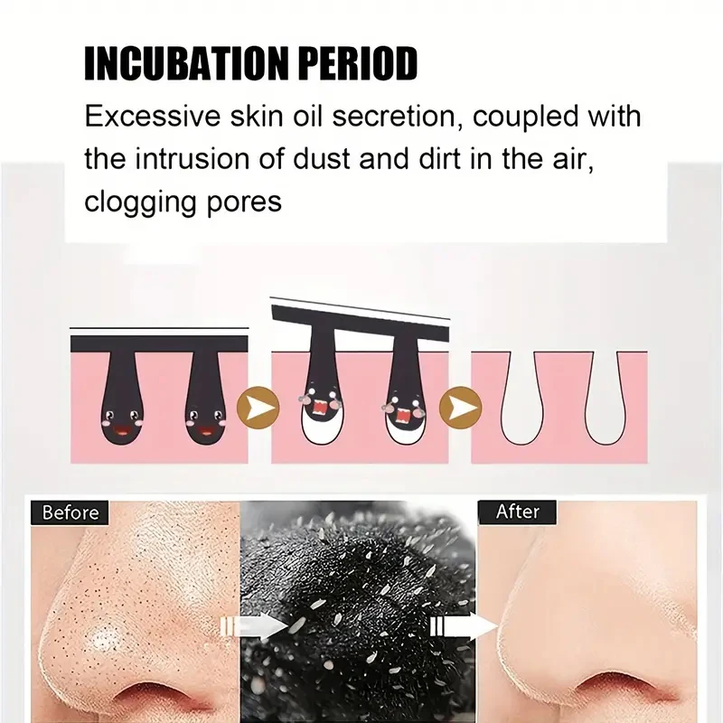 Nez points noirs enlever masque plâtre nez bandes enlever points noirs Pores points noirs dissolvant acné Peel masque Patch de nettoyage soins de la peau