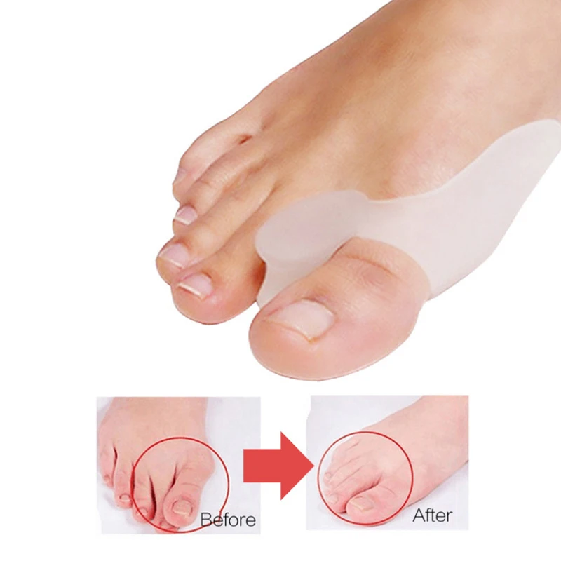 2PCS Silicone Gel Thumb Corrector Bunion Foot Toe Hallux Valgus Protector Separator Finger Straightener Adjuster Foot Care Tool