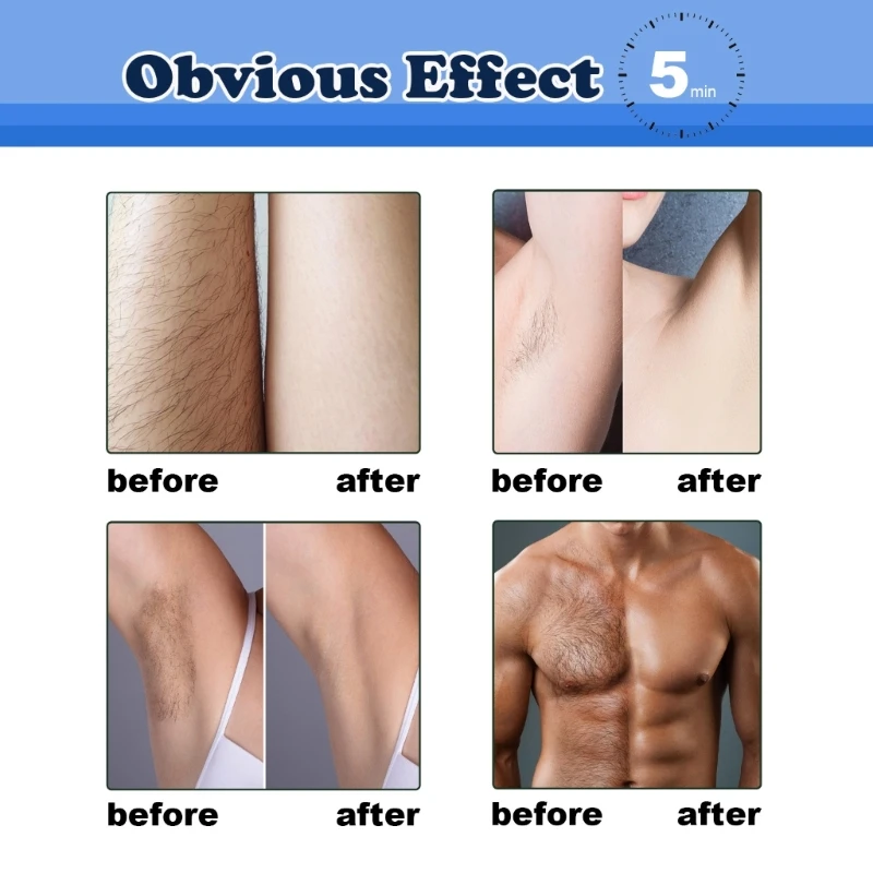 제모 크림 수염 겨드랑이 팔 다리 전용 부품 무통 전신