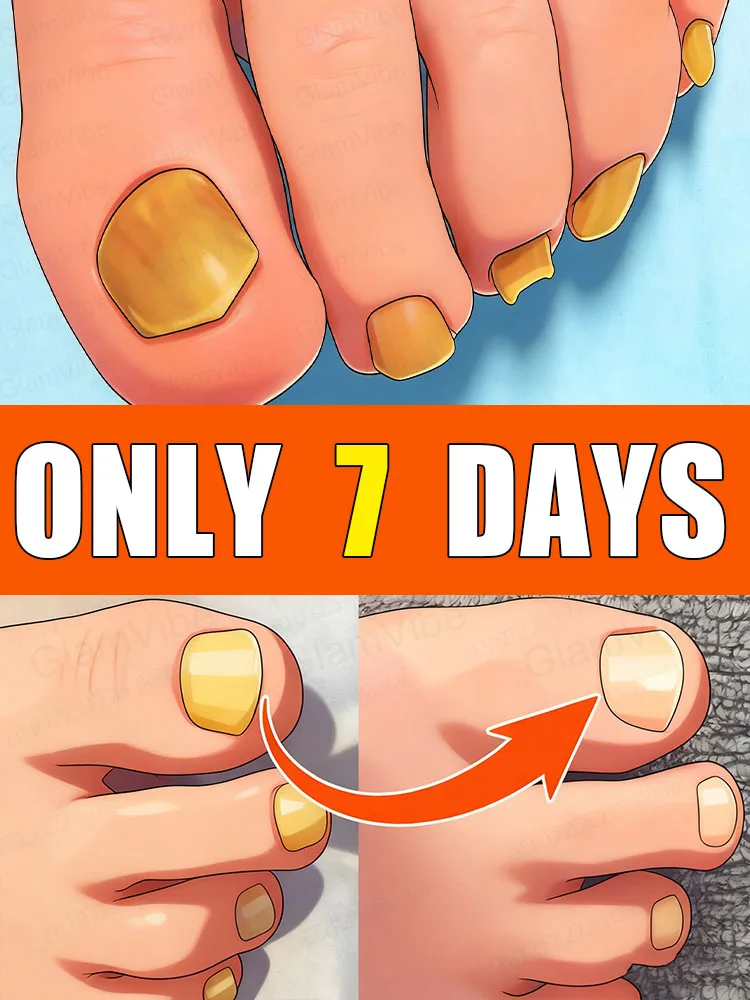 

Снижайте уровень тревоги и попрощайтесь с проблемами с ногтями. Пользуется широким признанием и пользуется огромной популярностью.