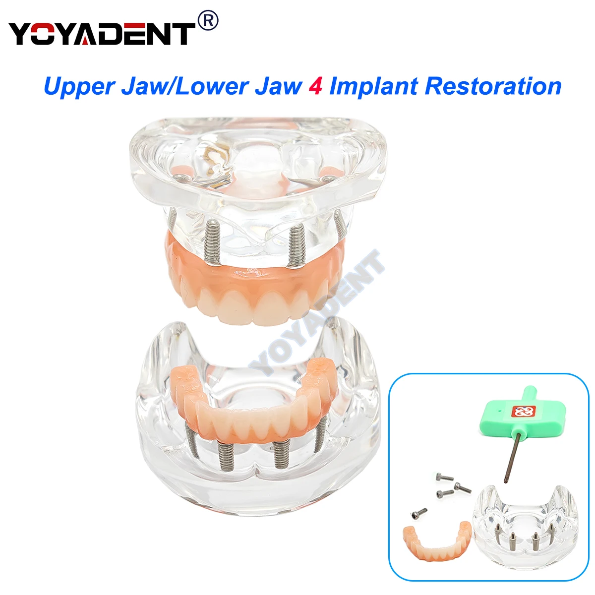 

Dental Implant Teeth Model Transparent Upper/Lower Jaw Type 4 Overdenture Modle With 4 Removable Screws Dentist Teaching Model