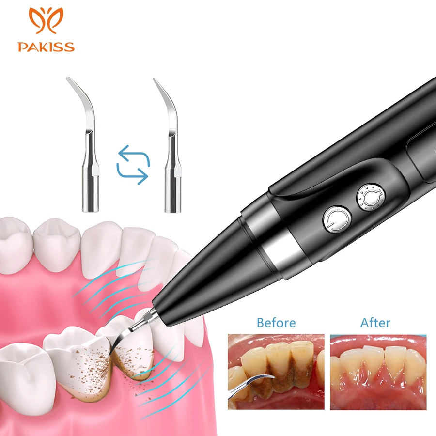 Ultrasonic Visual Tooth Cleaning Instrument Cleaning Tartar Stone Remover Home Dental Beauty Instrument Electric Tooth Cleaner