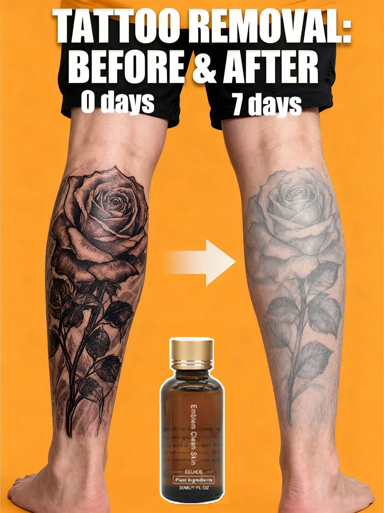 

Visibly lightens tattoos without damaging the dermis, safe and gentle