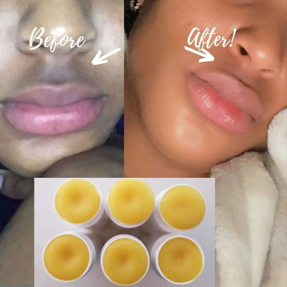 Rosa Lippen schnell Kurkuma Honig Kojic Zitrone Lippen balsam Bio Lippen balsam natürliche handgemachte feuchtigkeit spendende Lippen Aufhellung Aufhellung