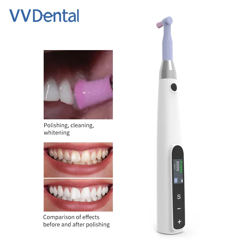 VV Dental Cordless Polishing Wireless Electric Motor With Prophy Angles Machine 3000rpm Rechargeable Polishing Instrument