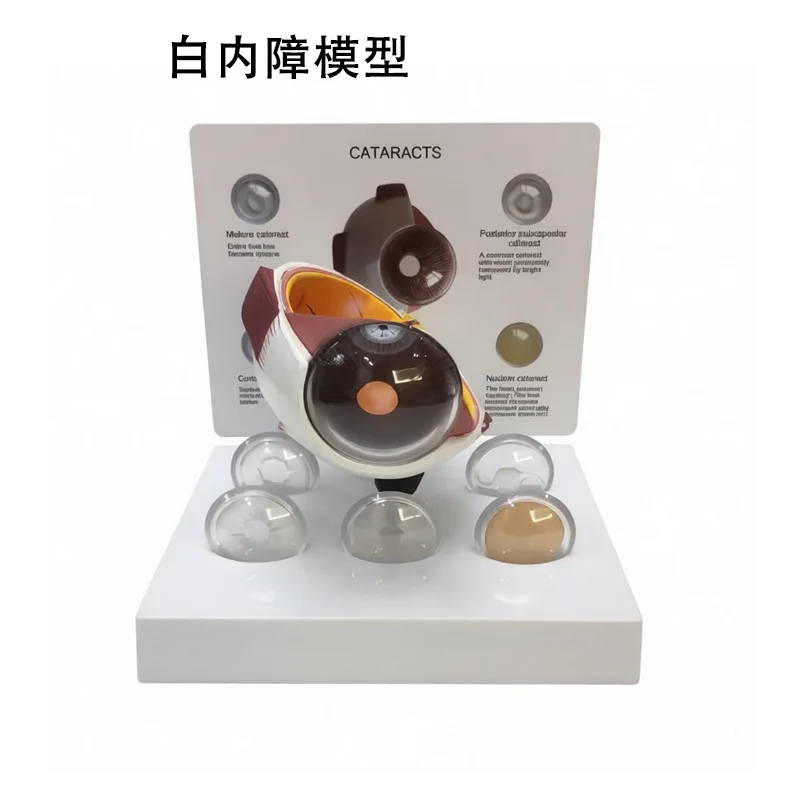 High Quality Six Times Enlarged Human Plastic Cataract Eye Anatomy Model Human Eye 6 Parts