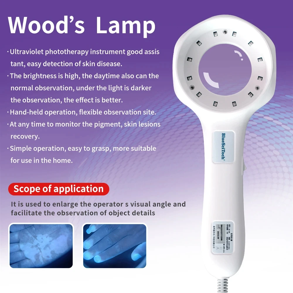 Ultraviolet Cat Moss Light Woods Lamp for Skin Analyzer Vitiligo Testing Examination Magnifying Analyze Machine Skin Detection