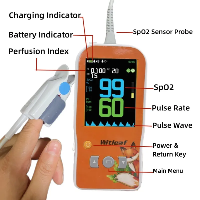 Witleaf Handheld Pulse Oximeter Professional Oximetro Pulso Neonatal Mother Kids Baby Pet Veterinary SPO2 PI PR Cardiac Monitor