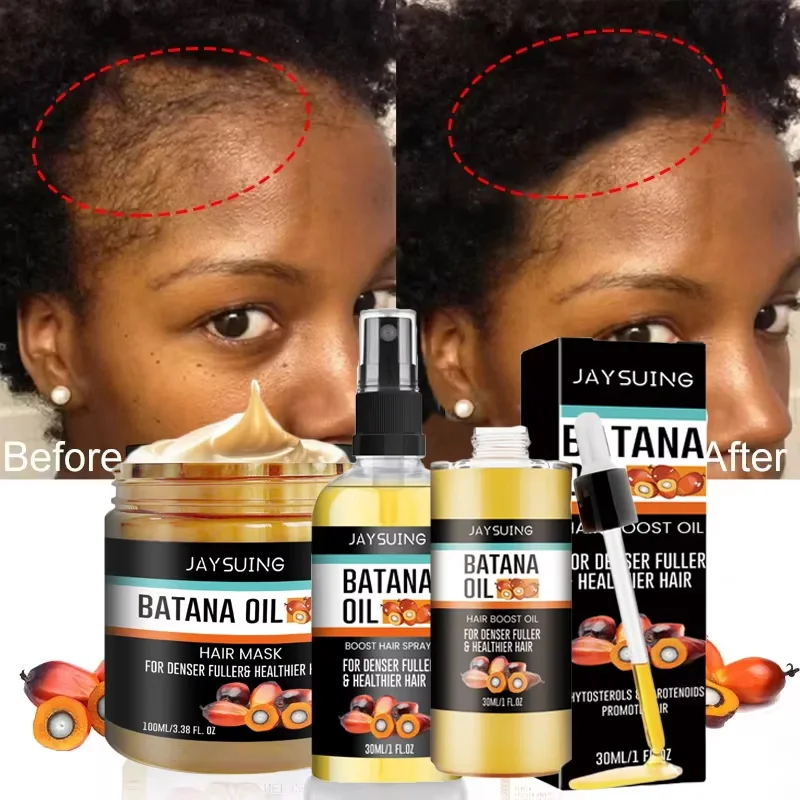 Batana Oil Thick Hair Serum Spray Repair Hair Nourish Root Follicle Regeneration  Hair Loss Essence Men Women Hair Care Products