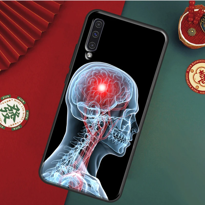 Medical Human Organs Brain For Samsung Galaxy A54 A34 A14 A53 A33 A13 A23 A73 A50 A51 A71 A12 A22 A32 A52 Phone Case